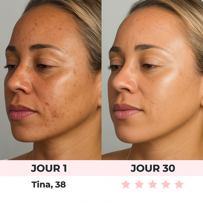 Masseur facial Essence Glow