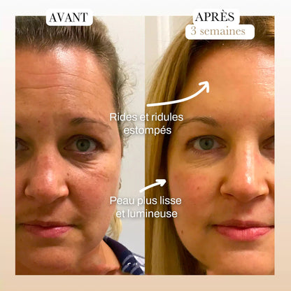 Masseur facial Essence Glow